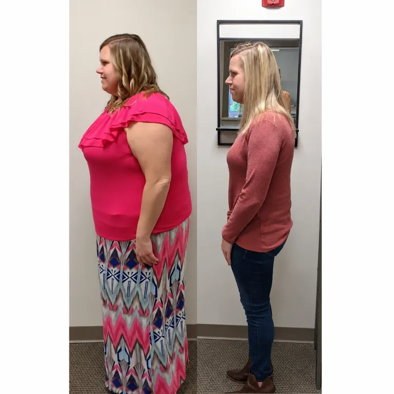 SlimRX patient before and after weight loss photos: 90+ Pounds